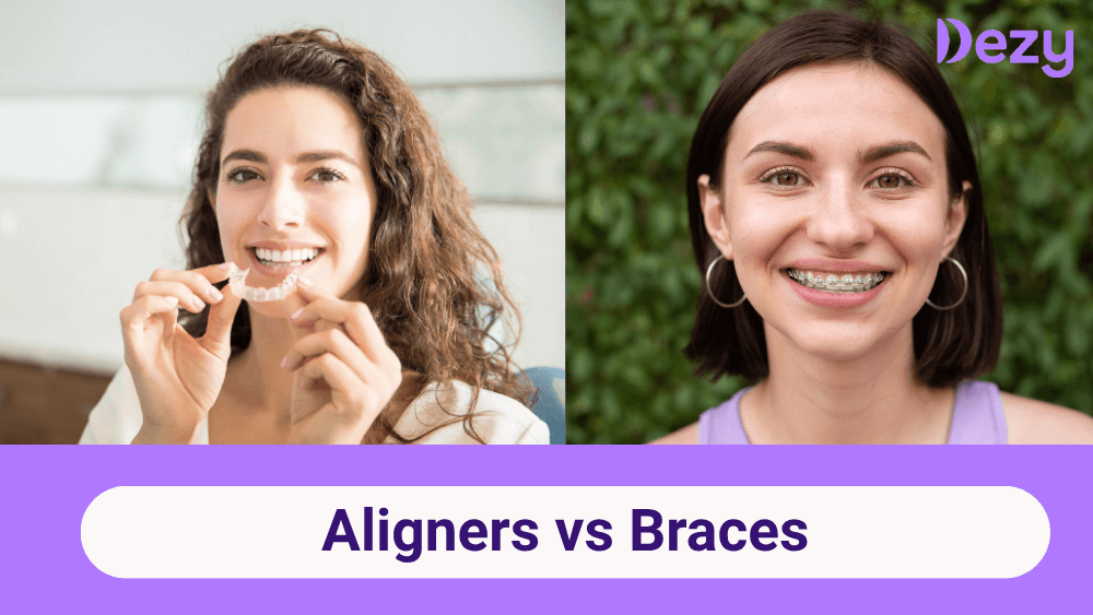 Aligners vs Braces: Which Is Best for Your Perfect Smile?
