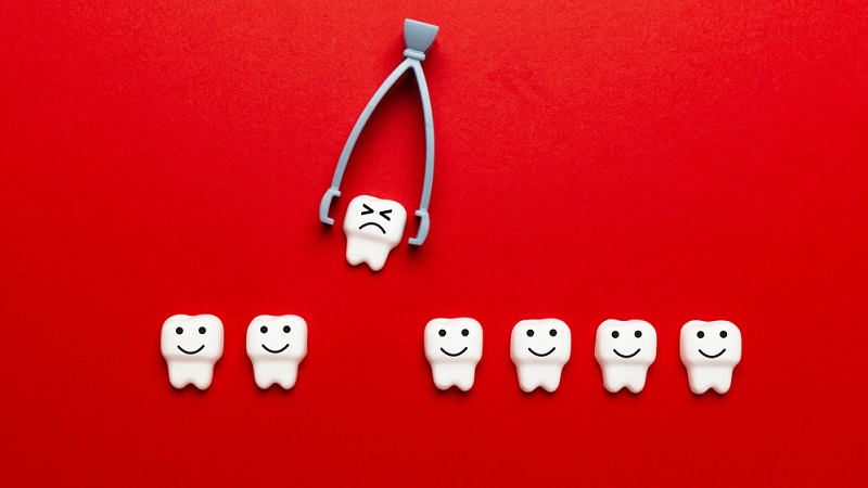 Benefits of Keeping Wisdom Teeth and the Disadvantages of Removing Them