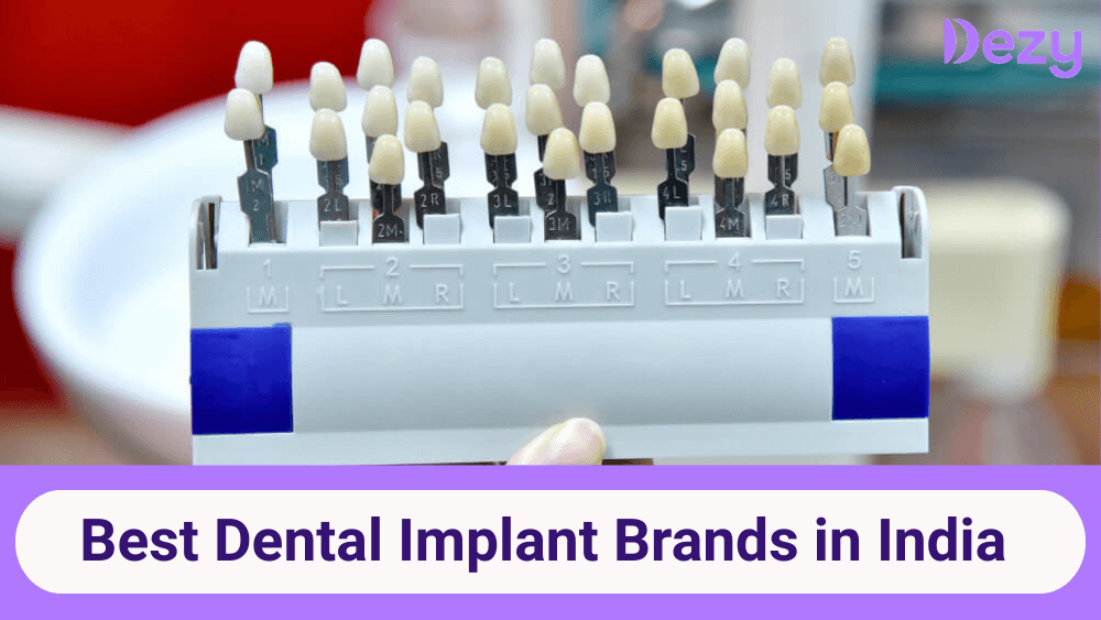 Best Dental Implant Brands in India 2026 | Prices & Brand Comparison
