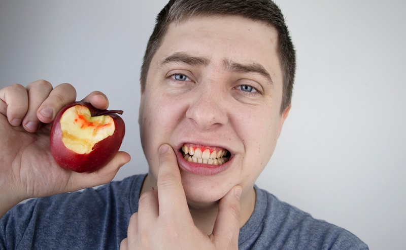 Exploring Bleeding Gums Symptoms from Dental Issues to Systemic Conditions