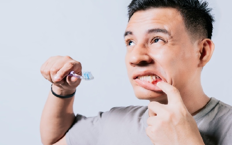 Bleeding Gums Treatment: What To Do If Your Gums Keep Bleeding?