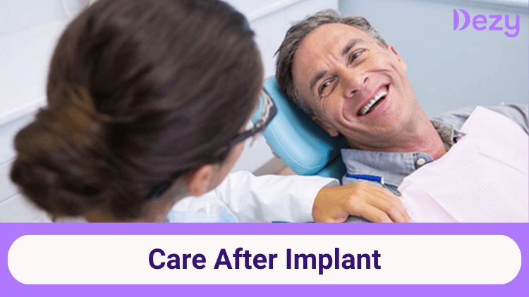 Care After Implant