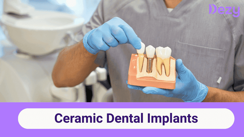 Ceramic Dental Implants: Benefits, Cost in India & Procedure