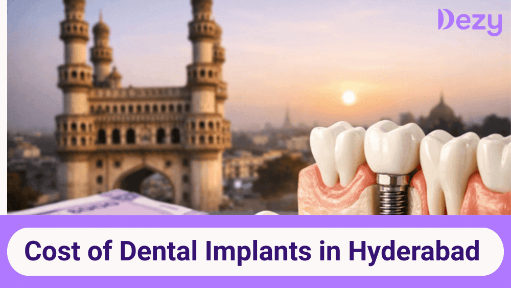 Dental Implants in Hyderabad