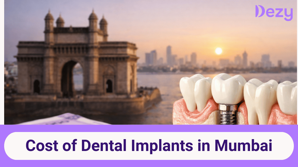 cost-of-dental-implants-in-mumbai