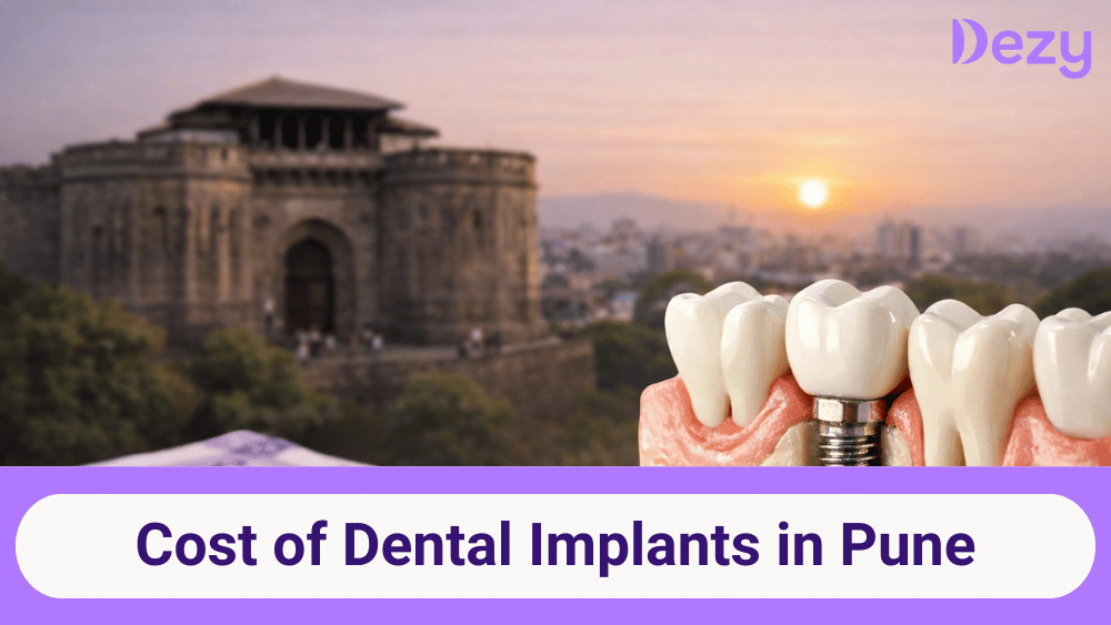 Dental Implants in Pune
