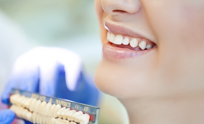 Dental Crown and Bridge: What Works Best for You?