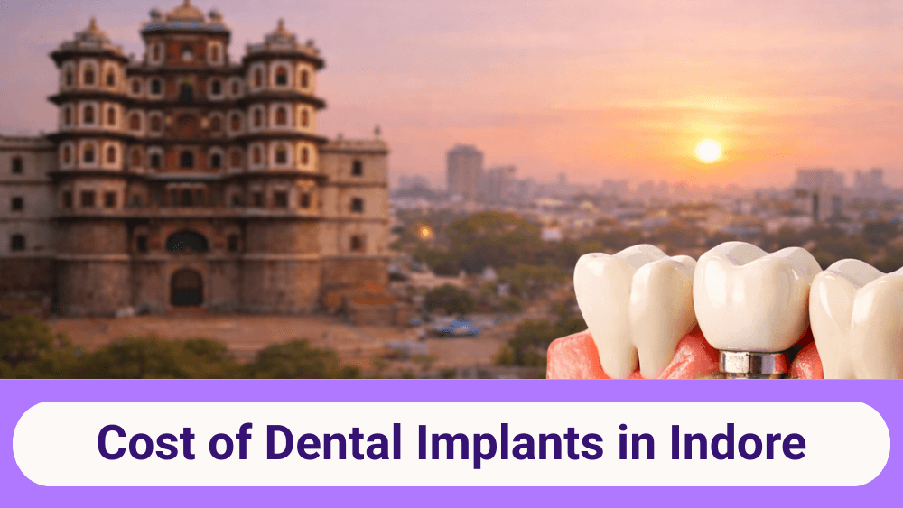 Dental Implant Cost in Indore