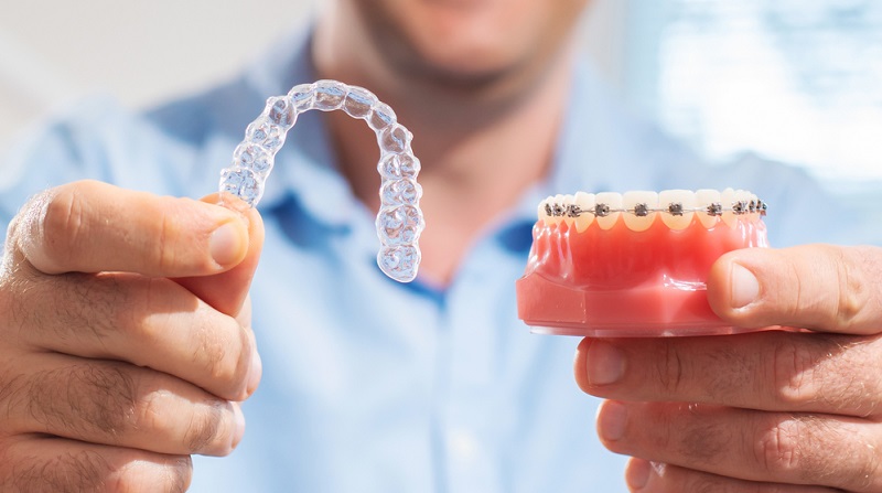 How Much Do Teeth Braces Cost in India?