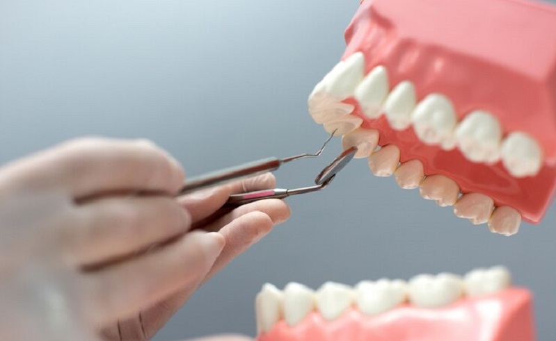 Denture Stomatitis: Know Symptoms, Causes, Types and Treatment