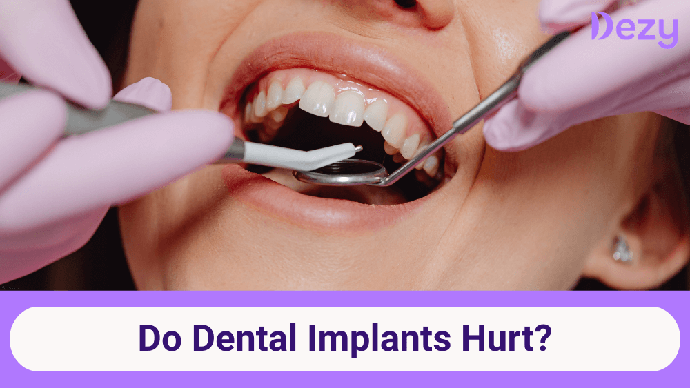 Do Dental Implants Hurt? 