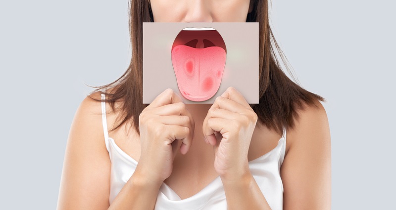 Foods That Cause Mouth Ulcers: What to Eat to Avoid Mouth Ulcers?