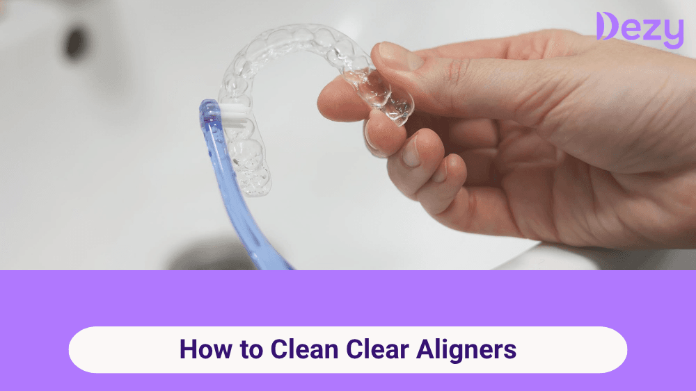 How to Clean Aligners: Best Cleaning Methods & Common Mistakes