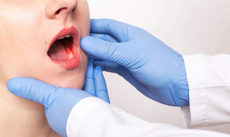 Jaw Cancer - Symptoms, Causes, Treatment and Survival Rate in India