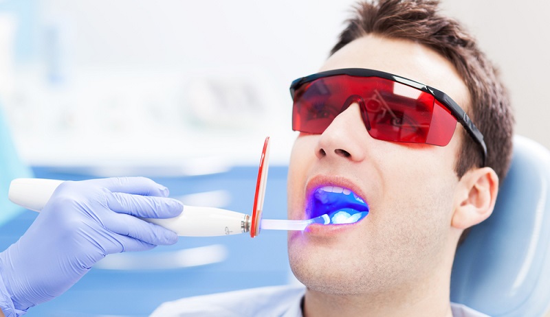 Laser Dentistry: How Does It Work, Benefits, Pros, and Cons