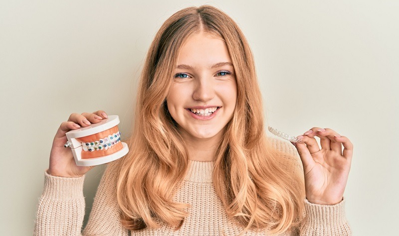 What are The Ortho Braces Options Available for Smile Correction?