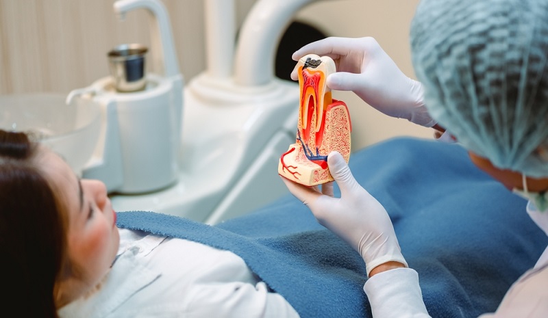 Root Canal Treatment Procedure Explained Step by Step