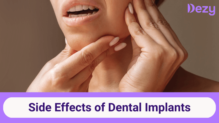 Side EffectsOf Dental Implants