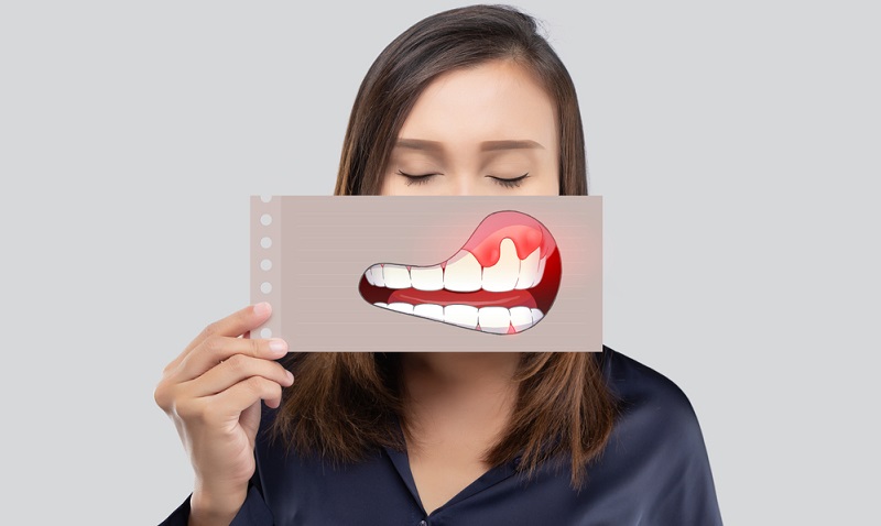 Swollen Gums: What Causes It and How to Treat Them?