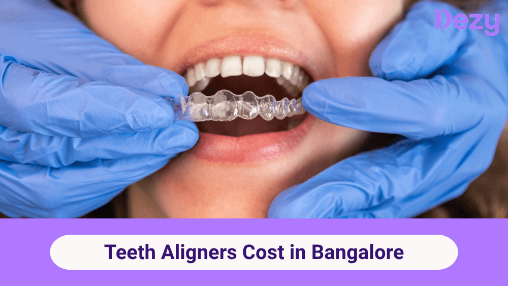 Invisible Aligners Cost in Bangalore: Price, Factors & EMI Options