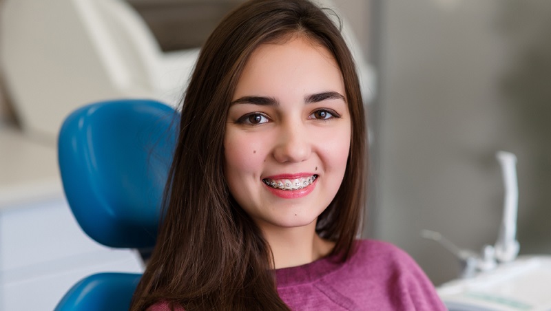 Teeth Braces Age Limit: Know What is the Best Age for Braces