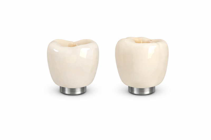Dental Implant - Temporary Crowns or Prosthetics