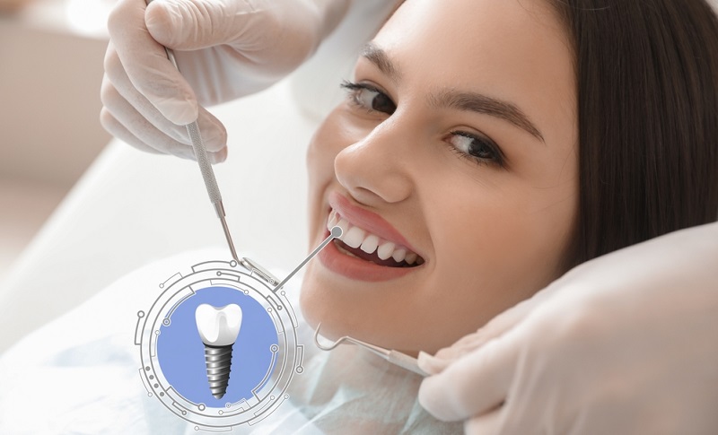 Titanium Dental Implants: Why It is Preferred Choice Among Dentists?