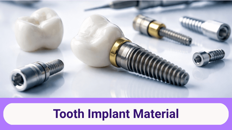 tooth-implant-material-1774413334330.png