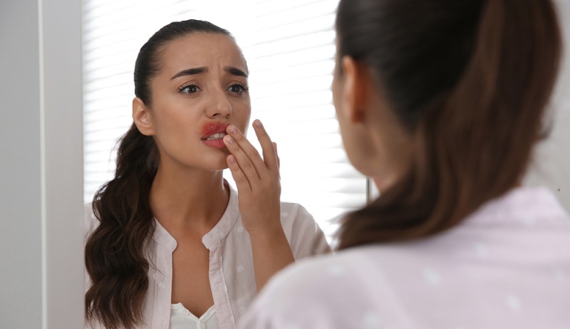 Mouth Ulcer Treatment: Best Treatment Options to Heal Instantly