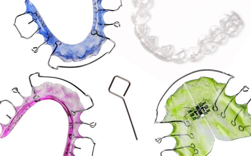 Types of Retainers and Their Pros & Cons: Which One to Choose?