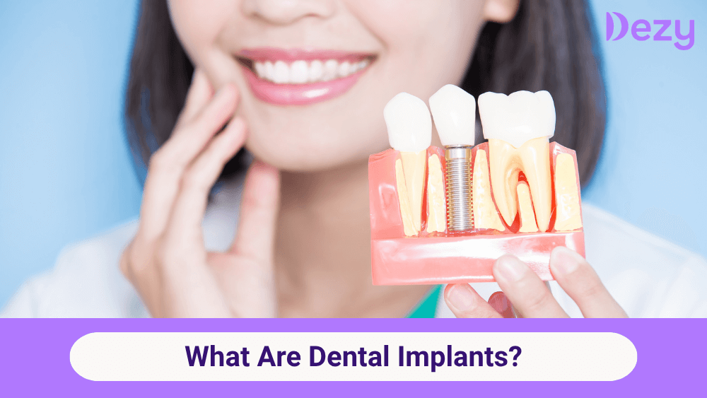 What Are Dental Implants? Procedure, Benefits & Cost in India