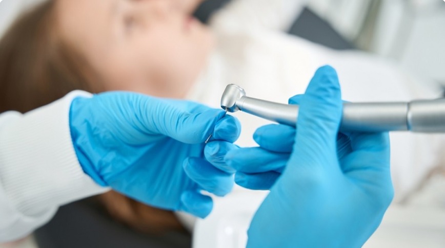 Steps of Cavity Preparation: Types and When to Use Them