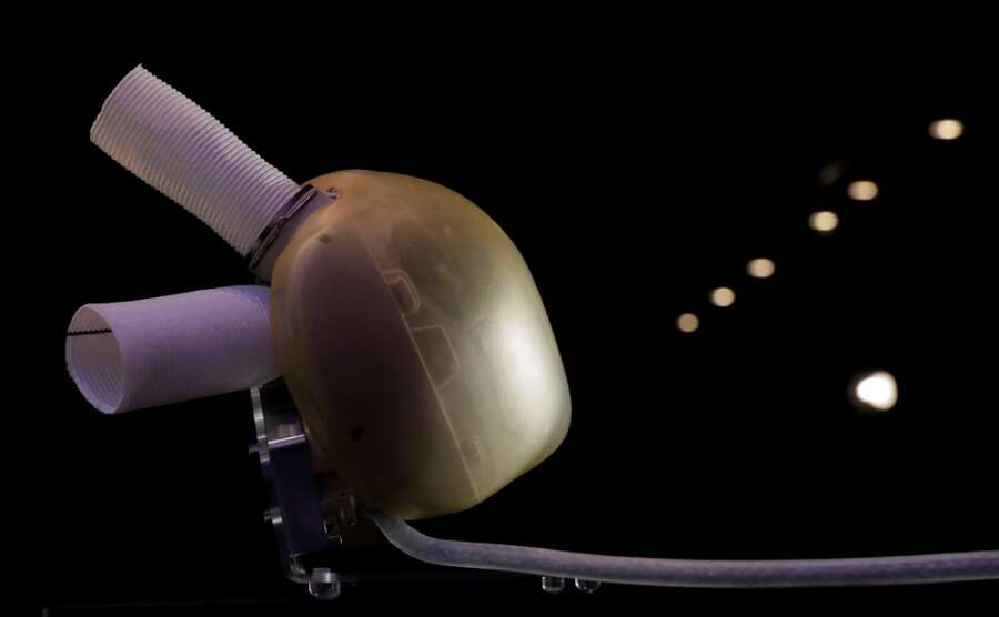 French artificial heart maker Carmat targets break-even in 2027