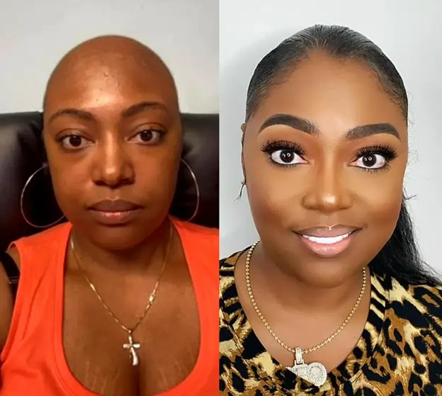 Turning Adversity into Opportunity: How Shashicka Tyre Hill Overcame Breast Cancer and Bullying