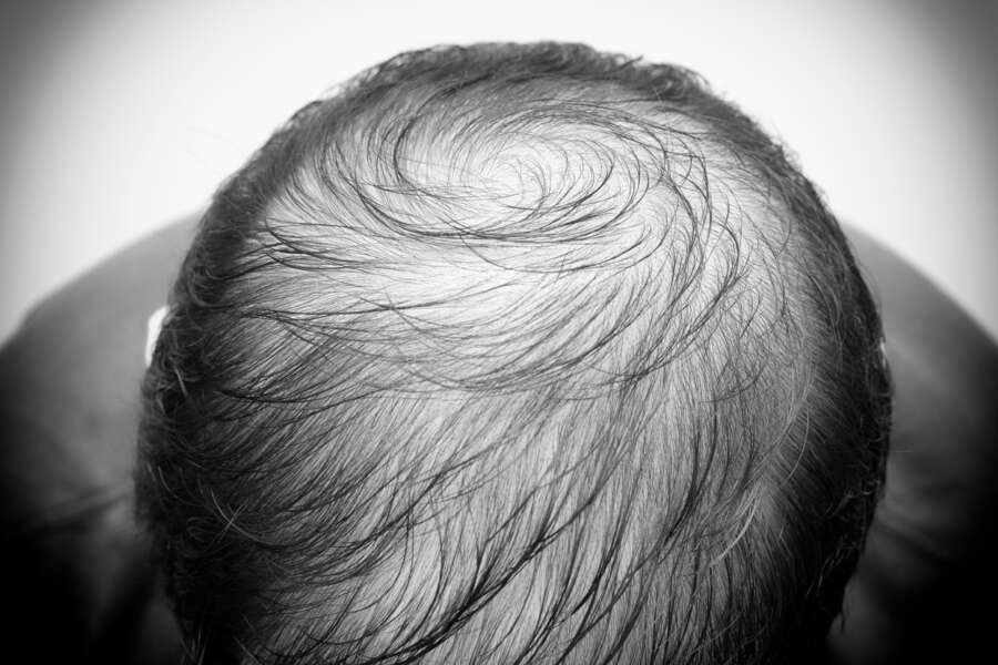 New AI GAN-Powered Virtual Try-on for Hairstyles Solution from Perfect Corp. is Poised to Elevate Hair Salon Experience