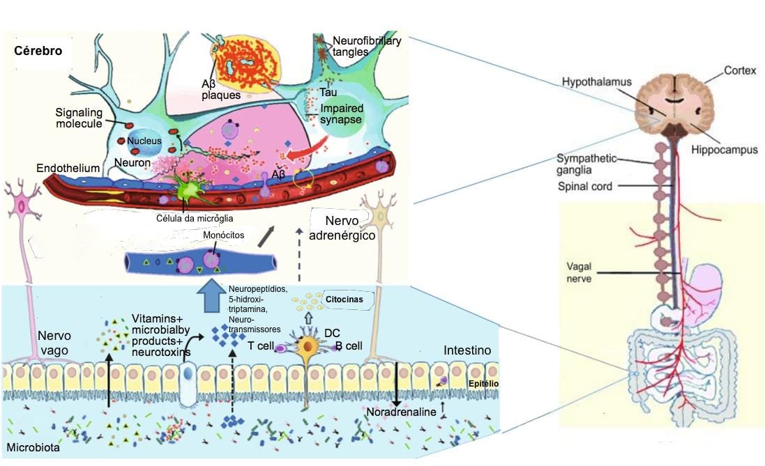 The gut microbiome have a role in Dementia