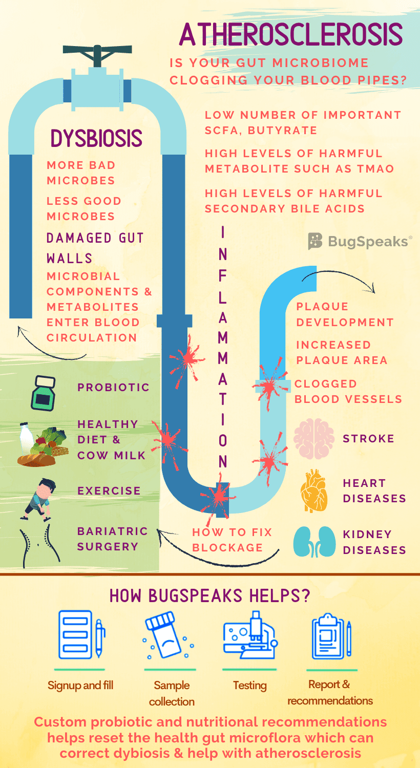 Gut Microbiome in Atherosclerosis: Unclogging the Bloody Pipes