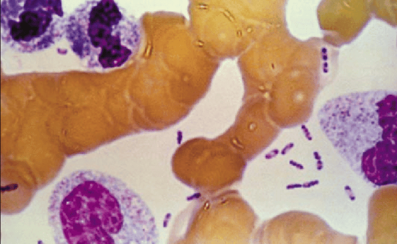 Yersinia pestis has dark ends under Wright’s stain, giving it a characteristic ‘safety pin’ appearance.