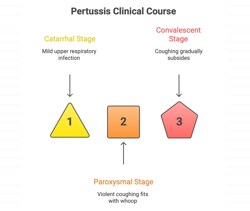 Pertussis Clinical Course