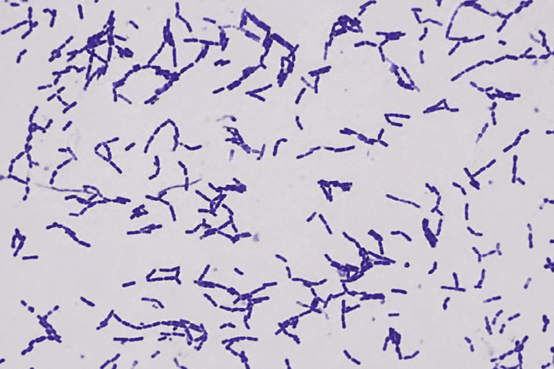 Lactobacillus gasseri