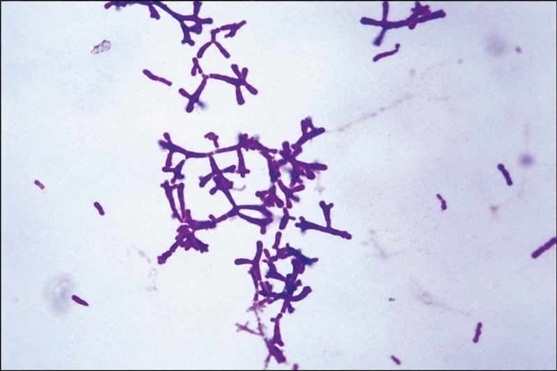 Bifidobacterium adolescentis
