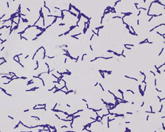 The MicroByte Series-Lactobacillus gasseri- A Maternal Gift for Gut Health