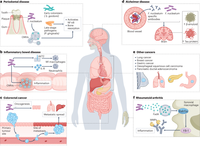 Role in Disease and Pathogenesis