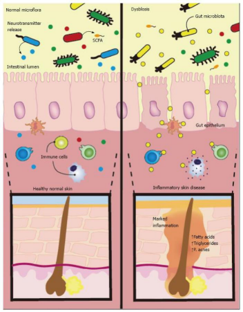 Diet for Healthy Skin: Nourish Your Skin  from Within