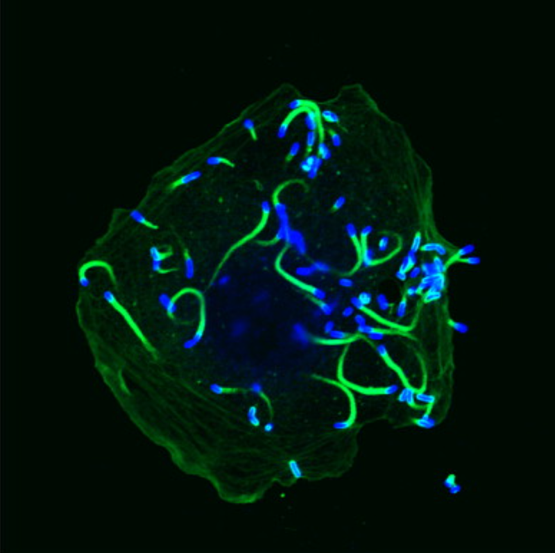 The MicroByte Pathogen Series: Listeria monocytogenes- The Intracellular Invader