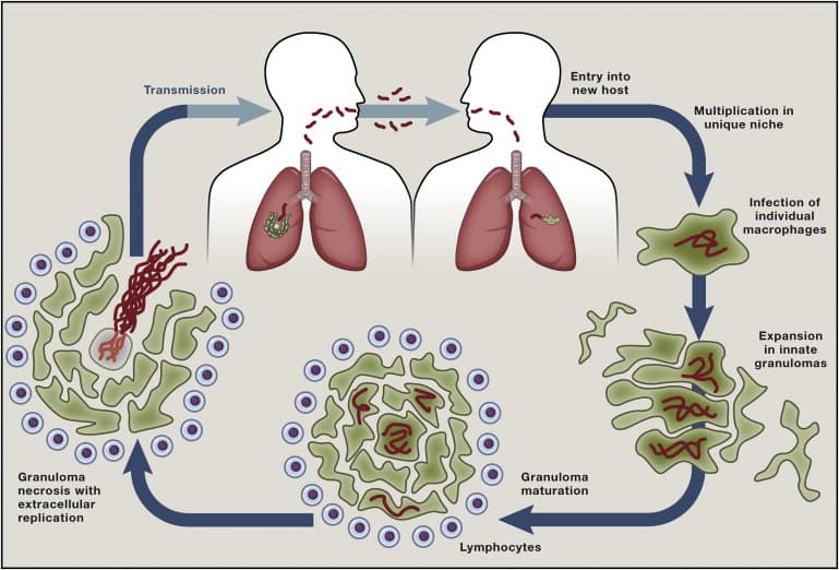 Life cycle of Mycobacterium tuberculosis