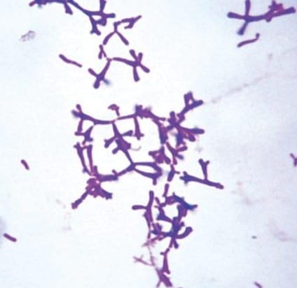 The MicroByte Series - The True Bifid: Bifidobacterium adolescentis?