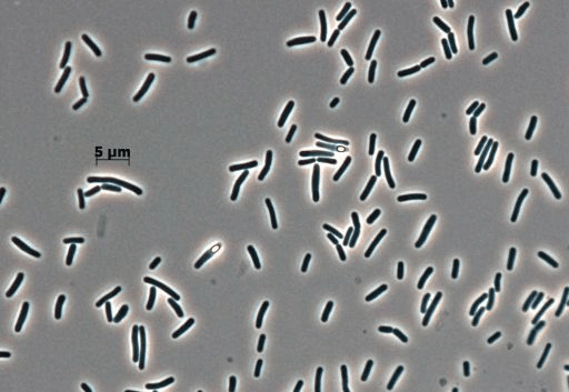 The MicroByte Series- Heyndrickxia coagulans: The Spore-Forming Probiotic