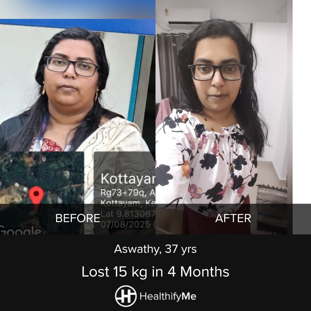 Kerala Fatty Liver Story: 15 kg Down in 4 Months