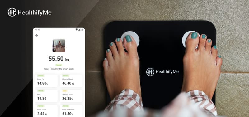 Introduction to Smart Scale